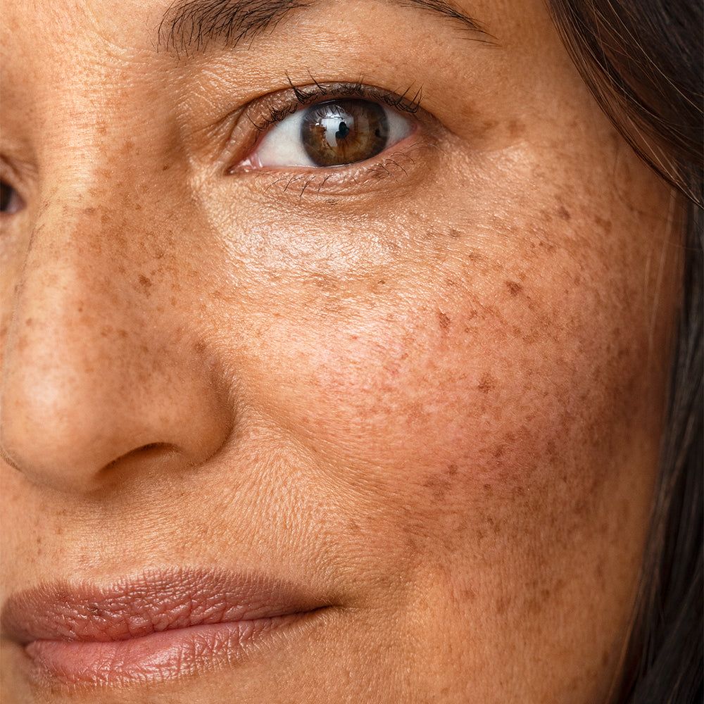 Protocolo LongevitySkin na AlmaraClinic