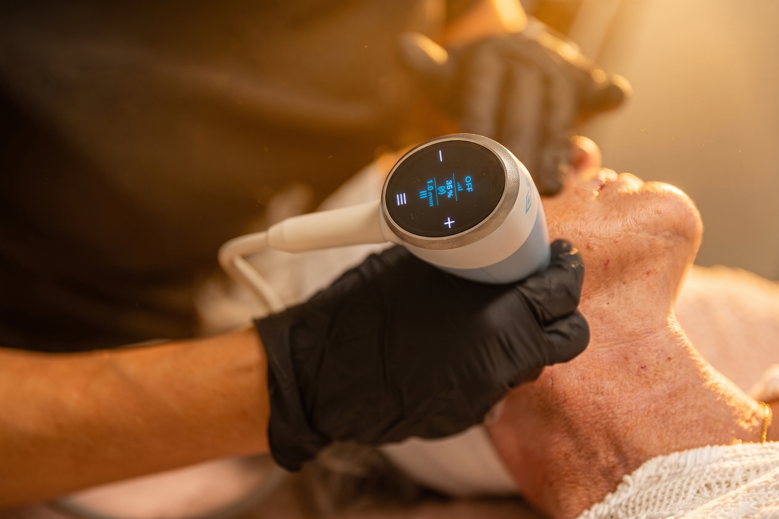 Tratamento facial na AlmaraClinic