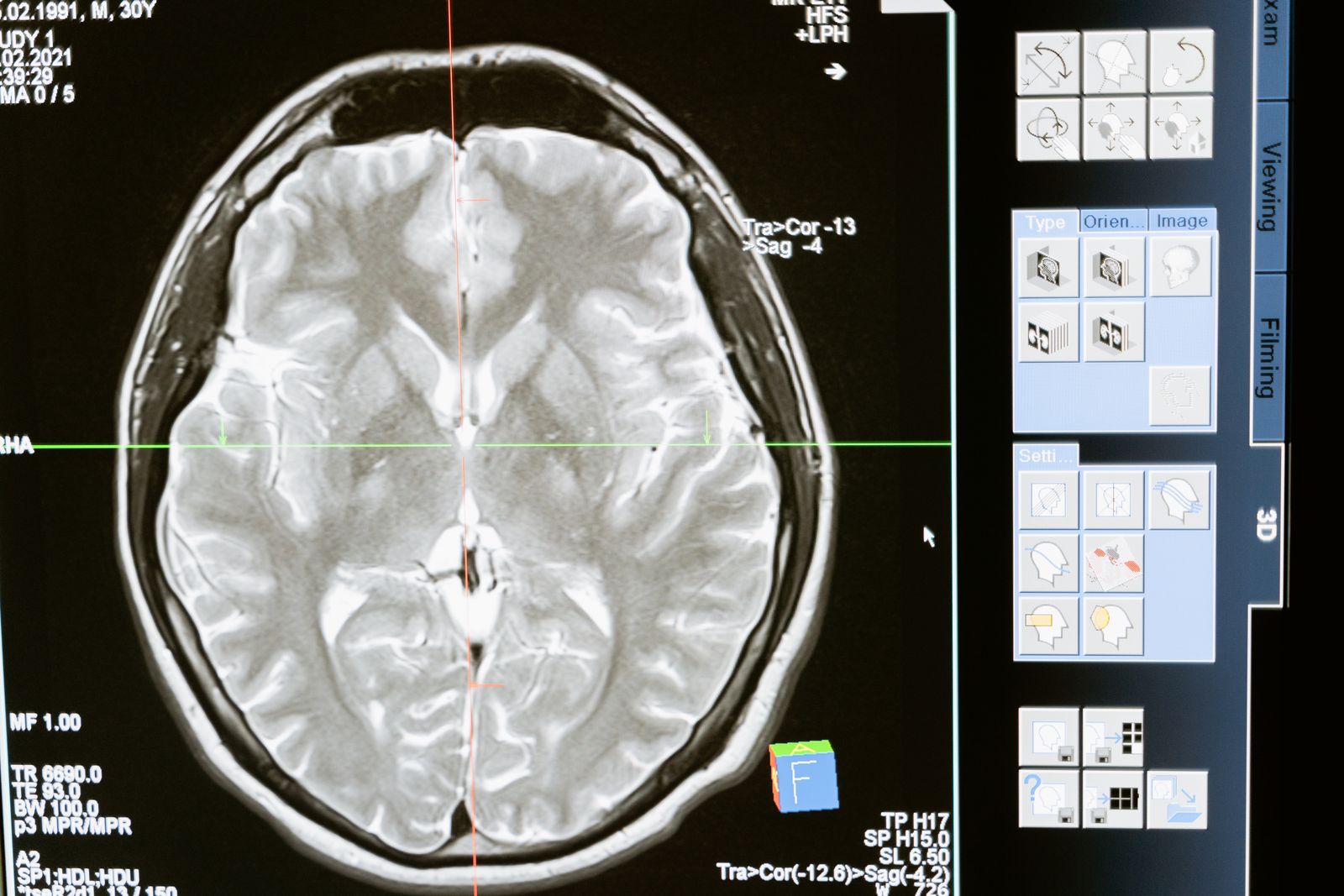 Imagem cerebral utilizada na avaliação clínica